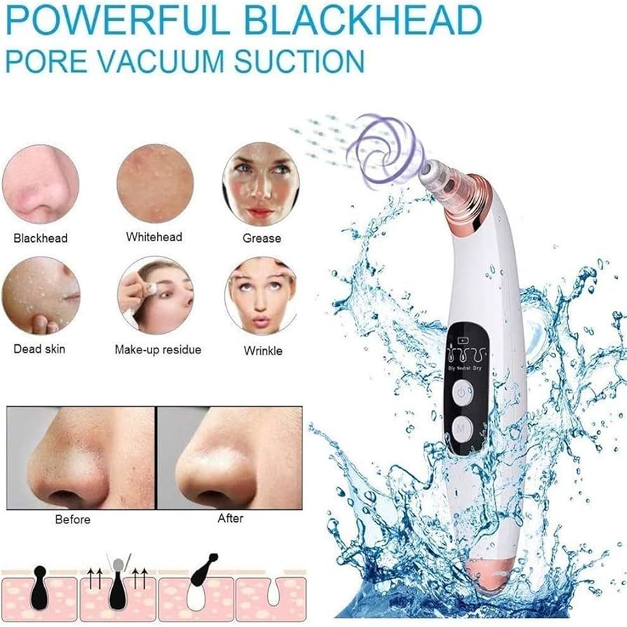 Advanced Pore Vacuum & Blackhead Extractor 2025