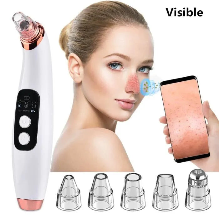 Advanced Pore Vacuum & Blackhead Extractor 2025