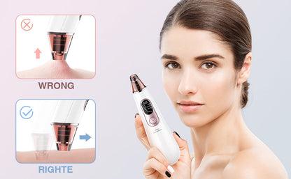 Advanced Pore Vacuum & Blackhead Extractor 2025