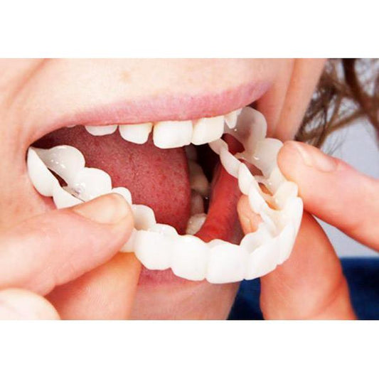 Snap on Veneers Upper and Lower 2 Pcs