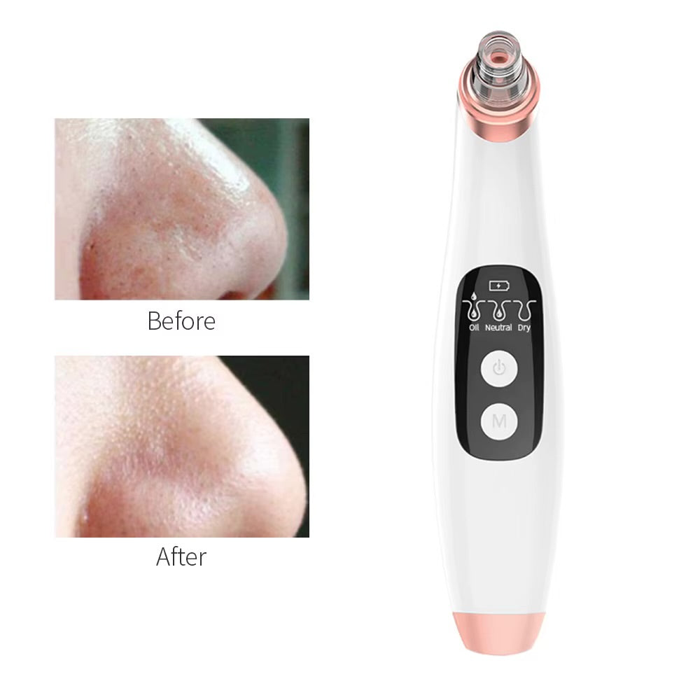 Advanced Pore Vacuum & Blackhead Extractor 2025