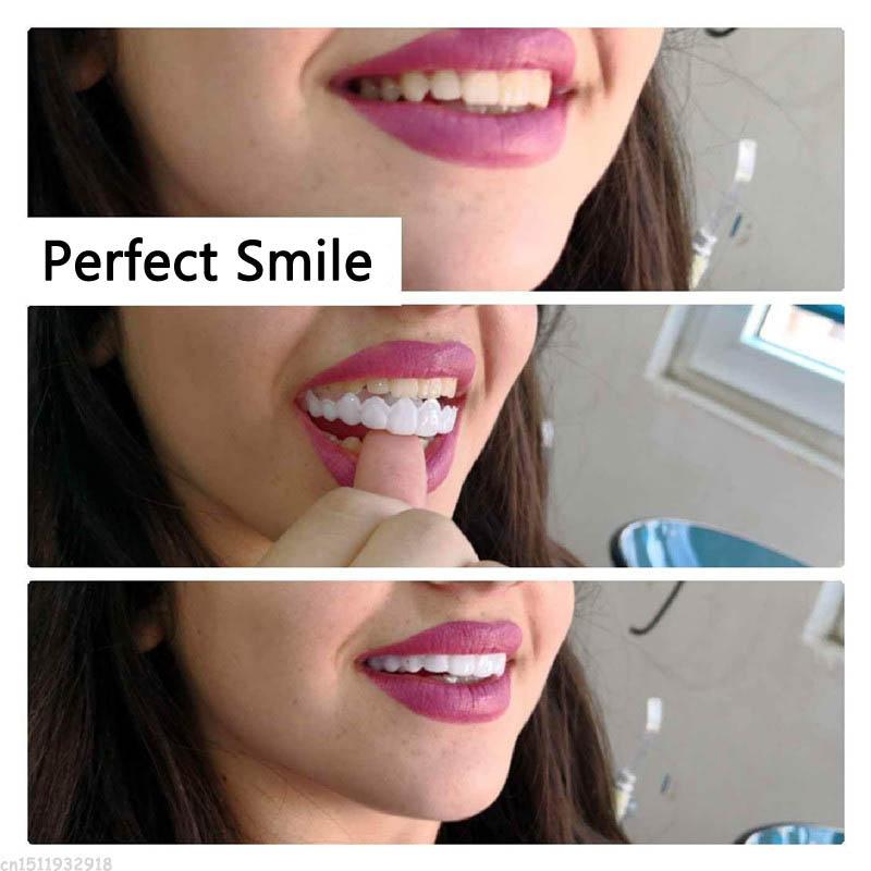 Snap on Veneers Upper and Lower 2 Pcs